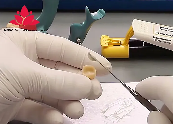 Crown Cementation-Clinical-Guidelines-Tips-and-Best-Practices-for-Success