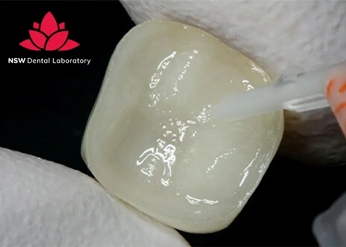 Crown Cementation-Clinical-Guidelines-Tips-and-Best-Practices-for-Success