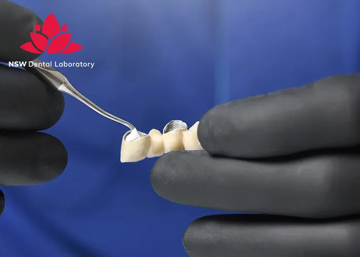 Crown Cementation-Clinical-Guidelines-Tips-and-Best-Practices-for-Success