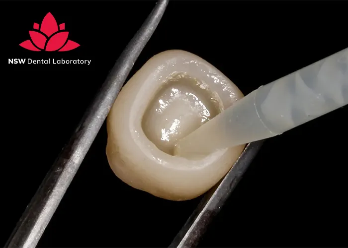 Crown Cementation-Clinical-Guidelines-Tips-and-Best-Practices-for-Success
