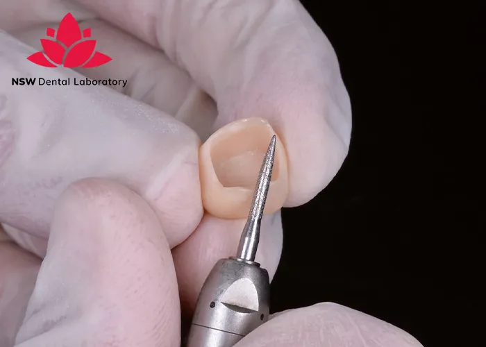 Crown Cementation-Clinical-Guidelines-Tips-and-Best-Practices-for-Success