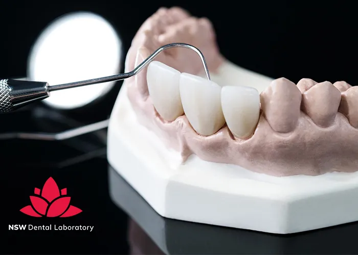 Experience-World-Class-Quality-at-NSW-Crown-Dental-Laboratory