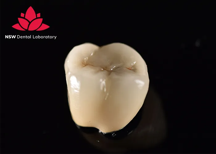 Experience-World-Class-Quality-at-NSW-Crown-Dental-Laboratory