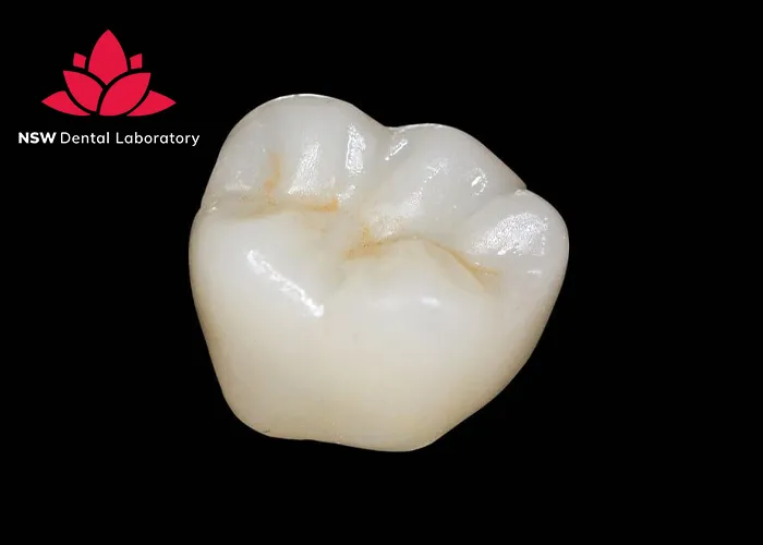 Experience-World-Class-Quality-at-NSW-Crown-Dental-Laboratory