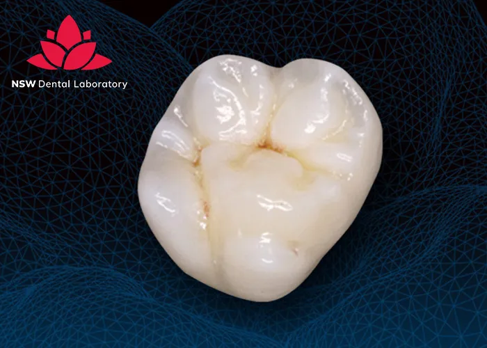 Experience-World-Class-Quality-at-NSW-Crown-Dental-Laboratory