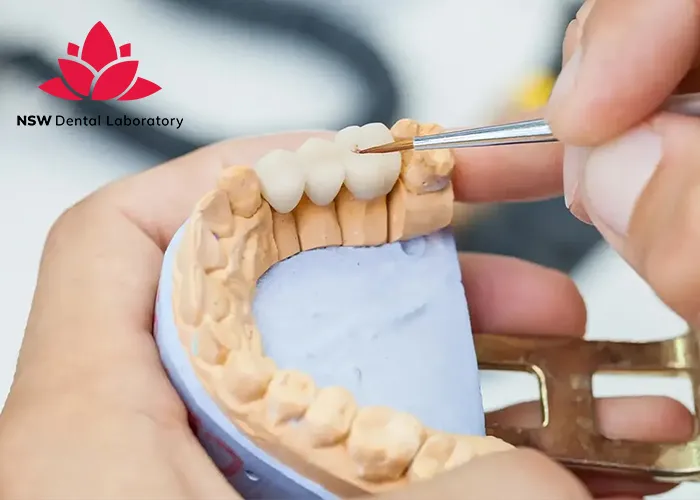 Experience-World-Class-Quality-at-NSW-Crown-Dental-Laboratory