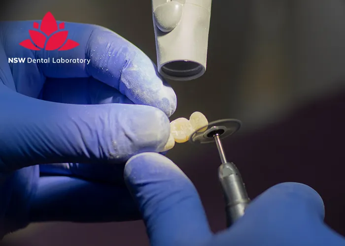 Experience-World-Class-Quality-at-NSW-Crown-Dental-Laboratory