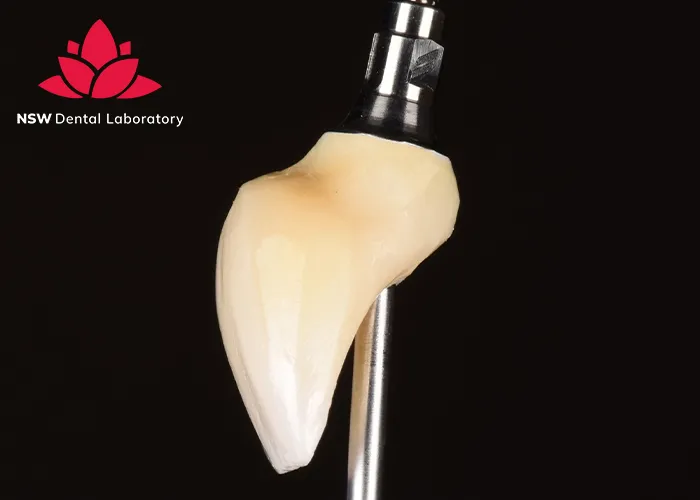 Dental-Bridge-And-Implant-Which-Is-The-Best-Choice-For-You