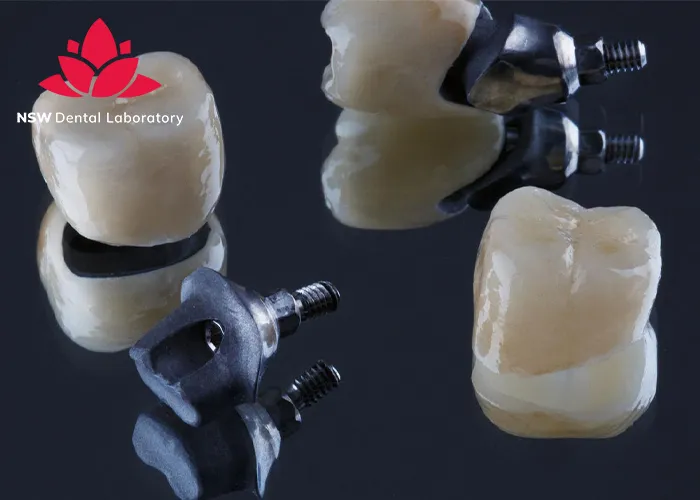 Dental-Bridge-And-Implant-Which-Is-The-Best-Choice-For-You