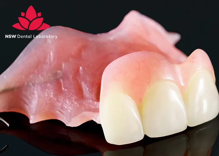 Implant-Bridge-For-Front-Teeth-Is-This-The-Best-Solution-Right-For-You?