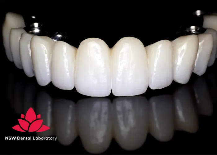 Implant-Bridge-For-Front-Teeth-Is-This-The-Best-Solution-Right-For-You?